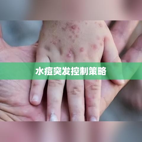 水痘突發(fā)控制策略